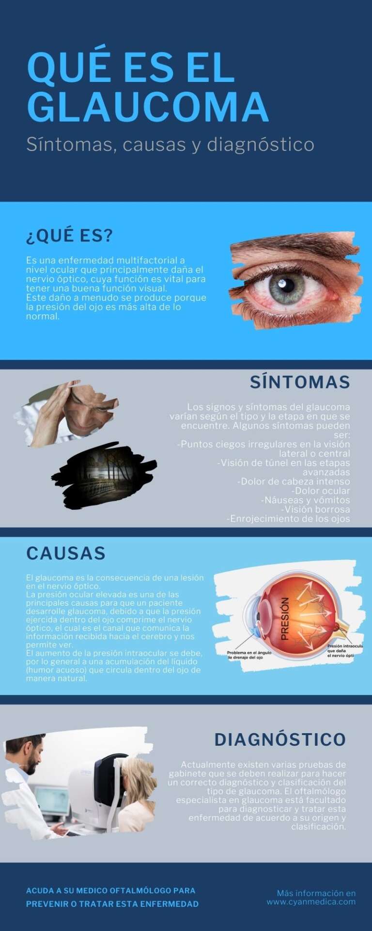 Glaucoma Síntomas Causas Y Diagnóstico Cyanmedica 5641